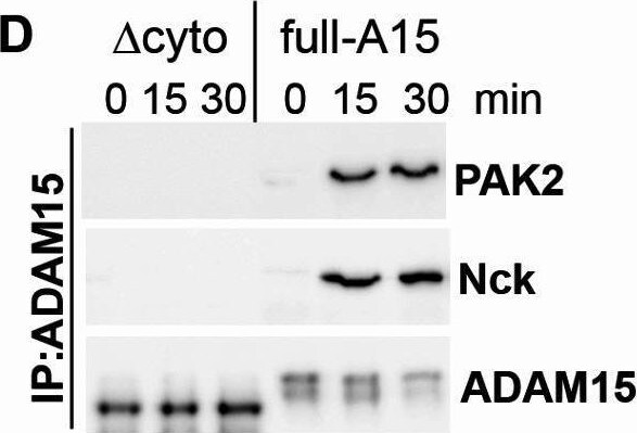 Detection of PAK2 by Western Blot