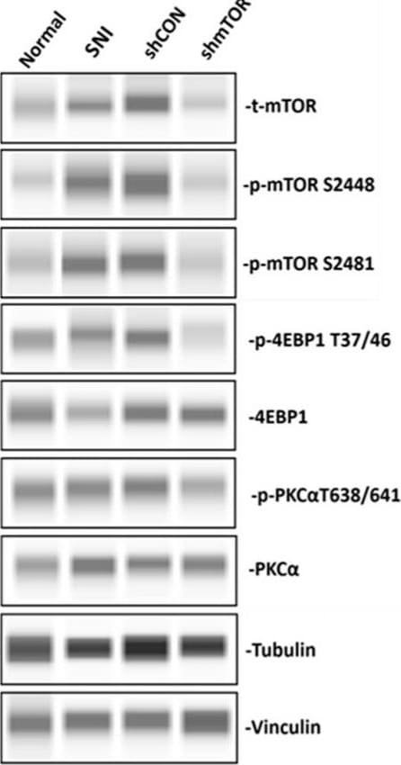 Human/Mouse/Rat Vinculin Antibody