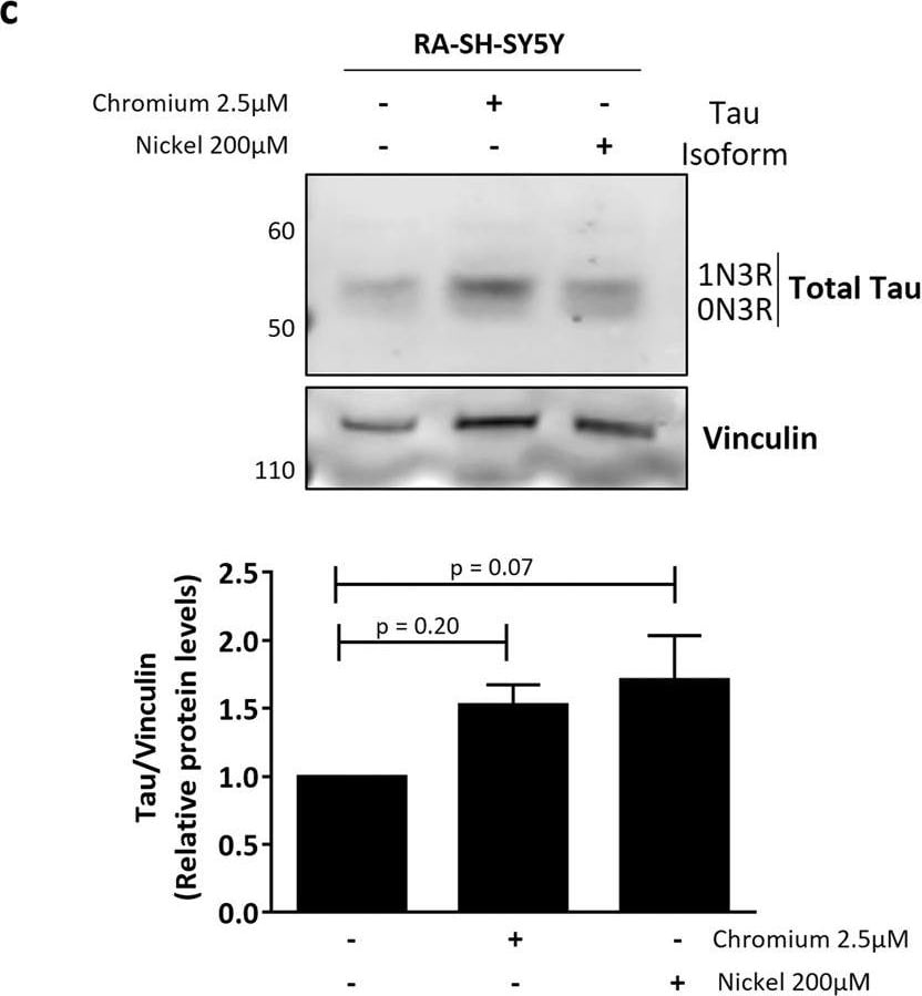 Detection of Human Vinculin by Western Blot