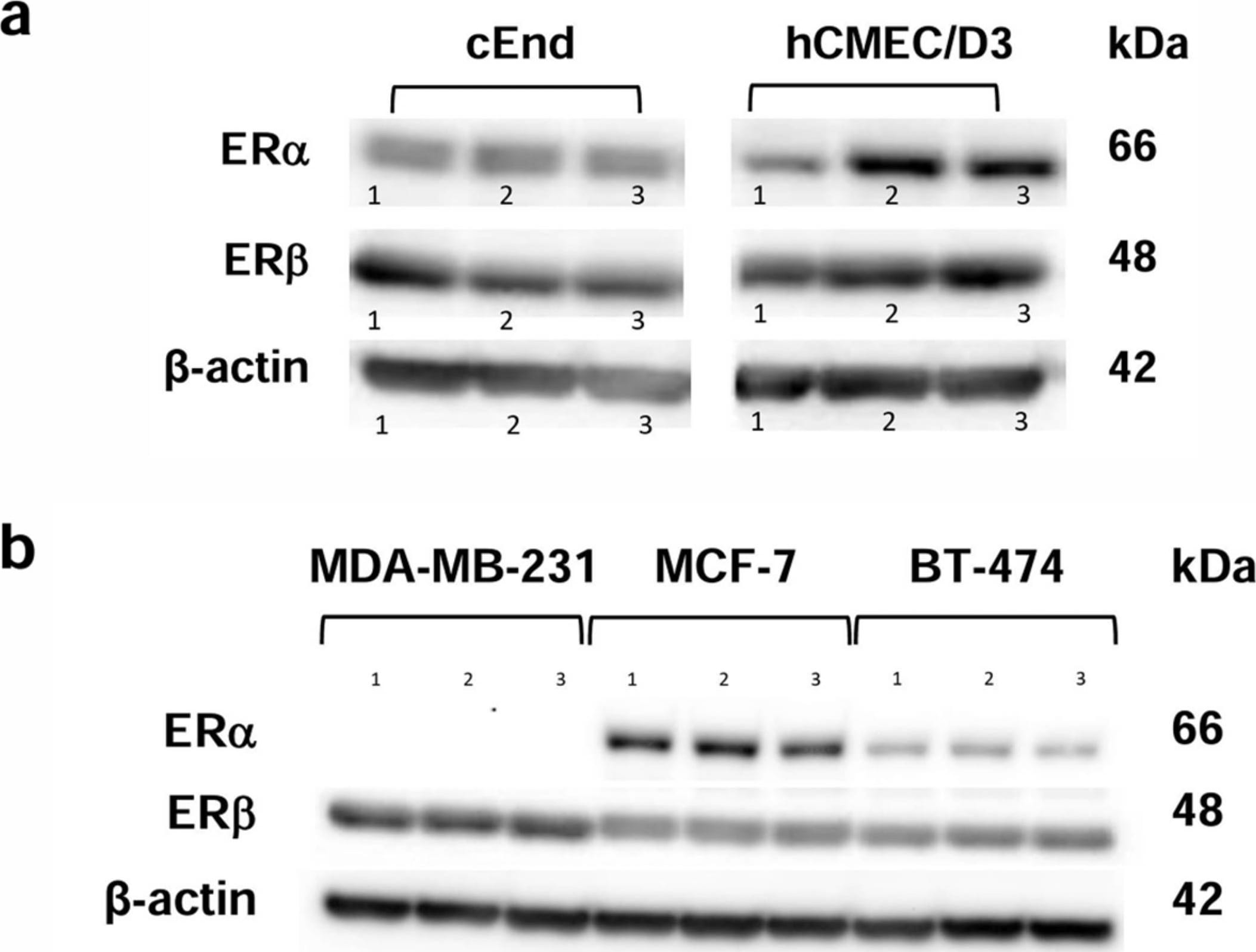 Detection of ER beta /NR3A2 by Western Blot