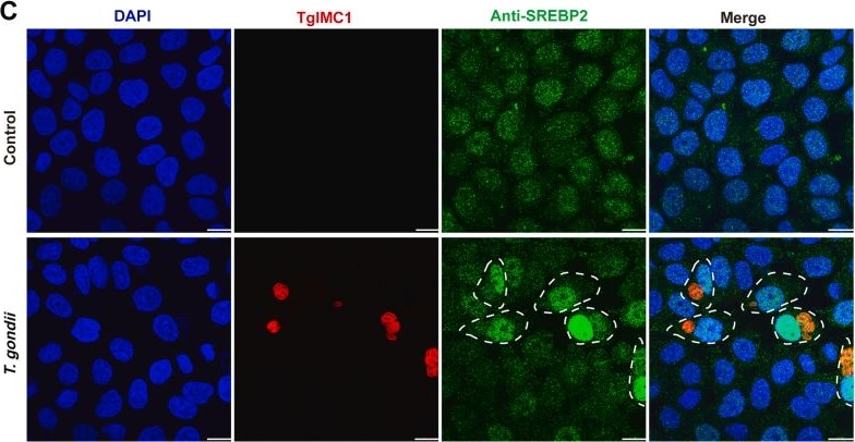 Detection of SREBP2 by Immunocytochemistry/ Immunofluorescence