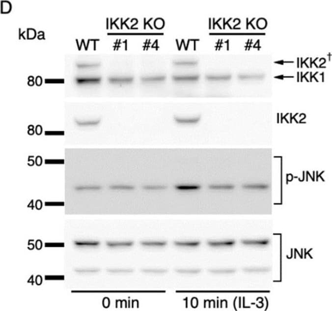 Detection of IKK beta  by Western Blot