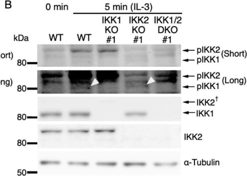 Detection of IKK beta  by Western Blot