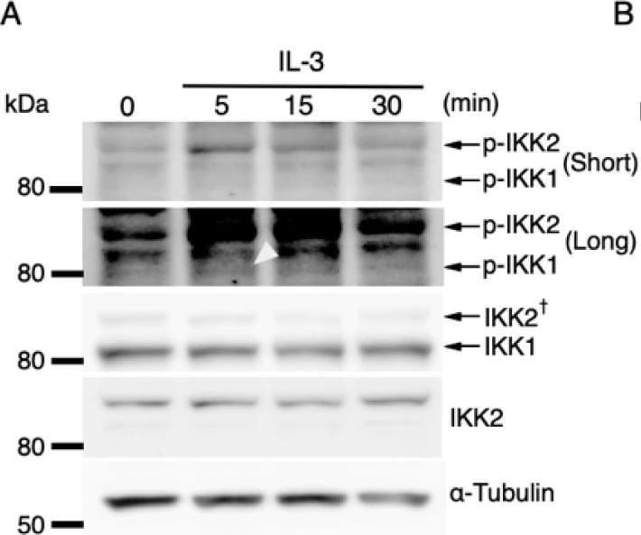 Detection of IKK beta  by Western Blot