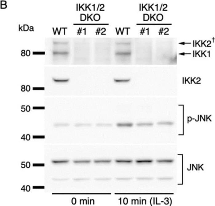 Detection of IKK beta  by Western Blot