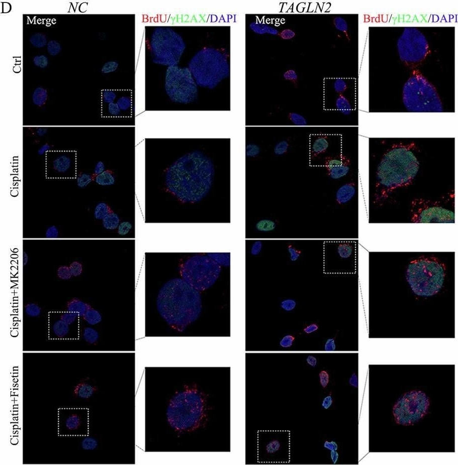 Detection of Bromodeoxyuridine/BrdU by Immunocytochemistry/ Immunofluorescence