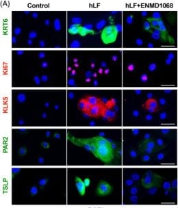 Detection of iklcw0hc3jaunbd2kt9w.jpg by Immunocytochemistry/ Immunofluorescence