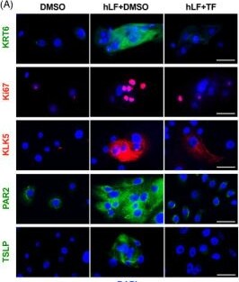 Detection of Kallikrein 5 by Immunocytochemistry/ Immunofluorescence