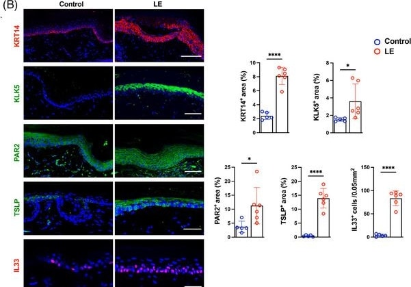 Detection of aitzzckyosadfm9rkedu.jpg by Immunohistochemistry