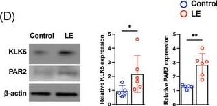 Detection of k0dh2dsr0tyqlt53m49z.jpg by Western Blot