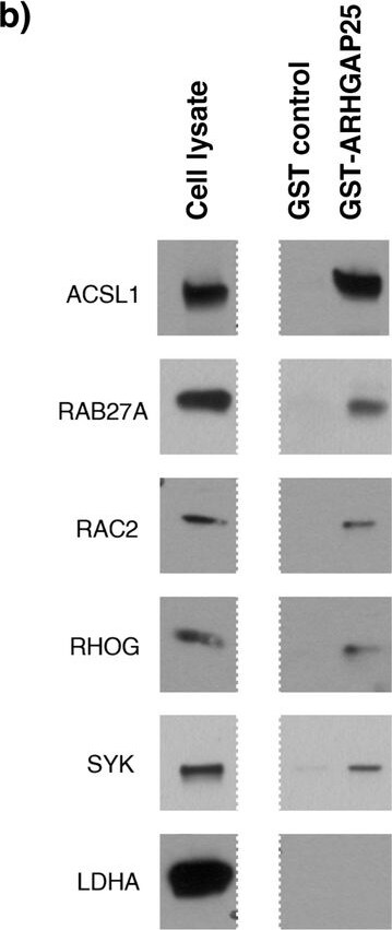 Detection of Human Rab27a by Western Blot
