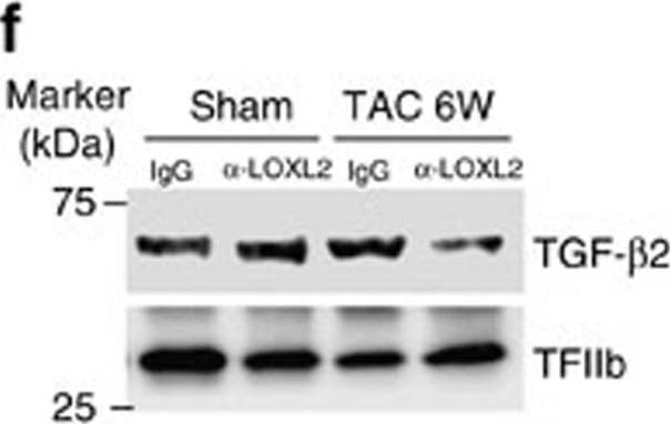 Detection of Human TGF-beta 2 by Western Blot