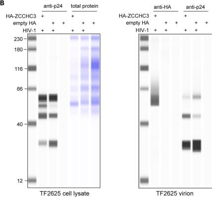 Detection of HIV-1 Gag p24 by Western Blot