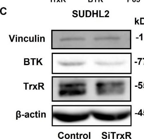 Detection of Thioredoxin Reductase 1/TRXR1 by Western Blot