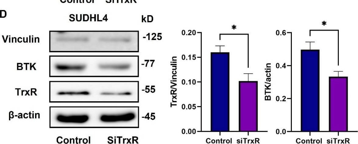 Detection of Thioredoxin Reductase 1/TRXR1 by Western Blot