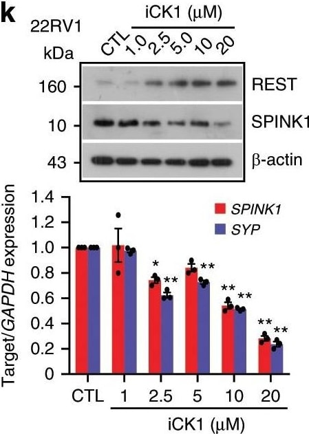 Detection of Human SPINK1 by Western Blot