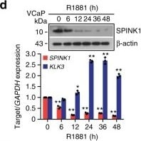 Detection of Human SPINK1 by Western Blot