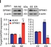 Detection of Human SPINK1 by Western Blot