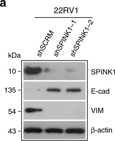 Detection of Human SPINK1 by Western Blot