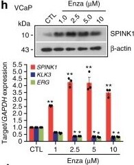Detection of Human SPINK1 by Western Blot