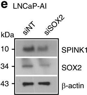 Detection of Human SPINK1 by Western Blot