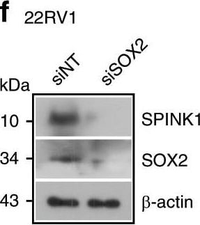 Detection of Human SPINK1 by Western Blot