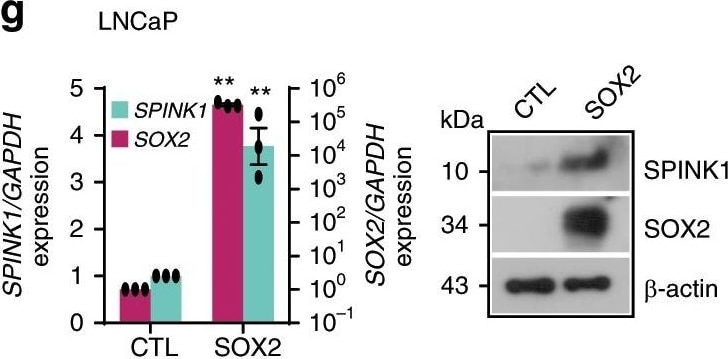 Detection of Human SPINK1 by Western Blot