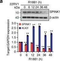 Detection of Human SPINK1 by Western Blot