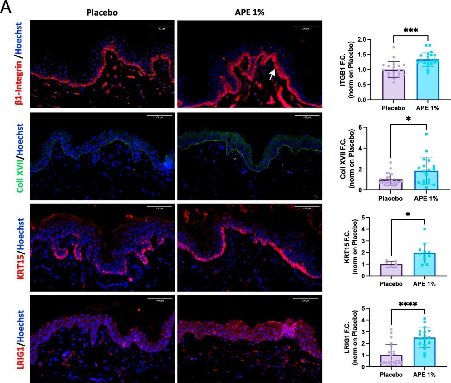 Detection of LRIG1 by Immunohistochemistry