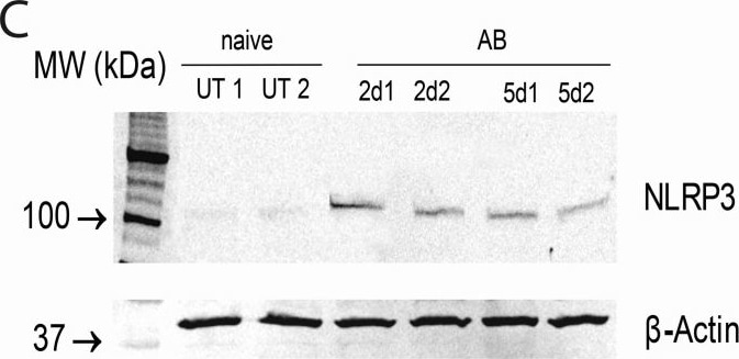 Detection of Mouse NLRP3/NALP3 by Western Blot