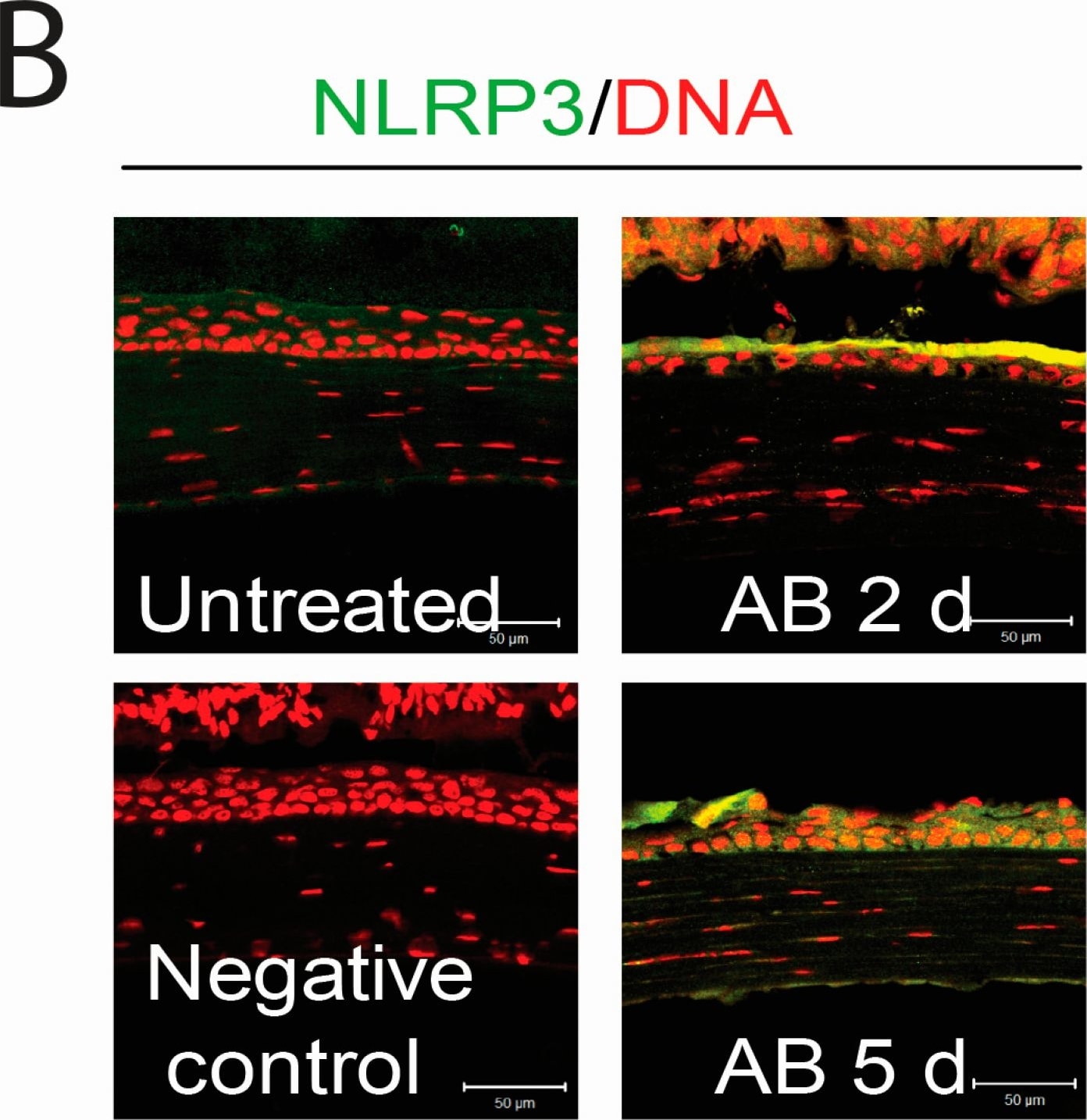 Detection of Mouse NLRP3/NALP3 by Immunocytochemistry/Immunofluorescence