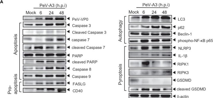 Detection of RIPK3/RIP3 by Western Blot