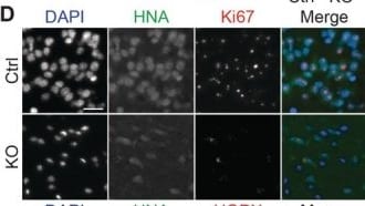 Detection of Ki67/MKI67 by Immunocytochemistry/ Immunofluorescence