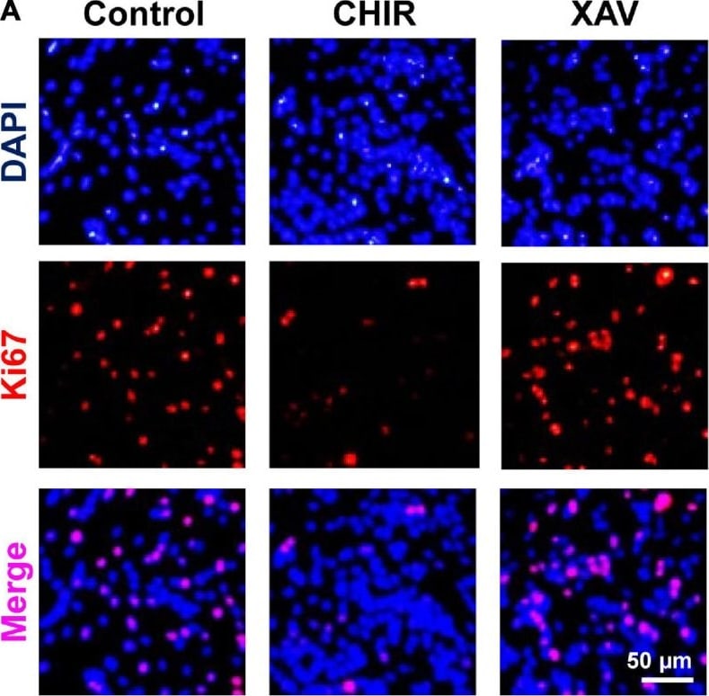 Detection of Ki67/MKI67 by Immunocytochemistry/ Immunofluorescence