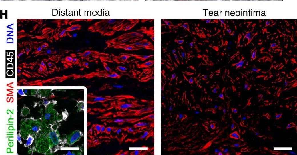 Detection of Perilipin-2 by Immunohistochemistry