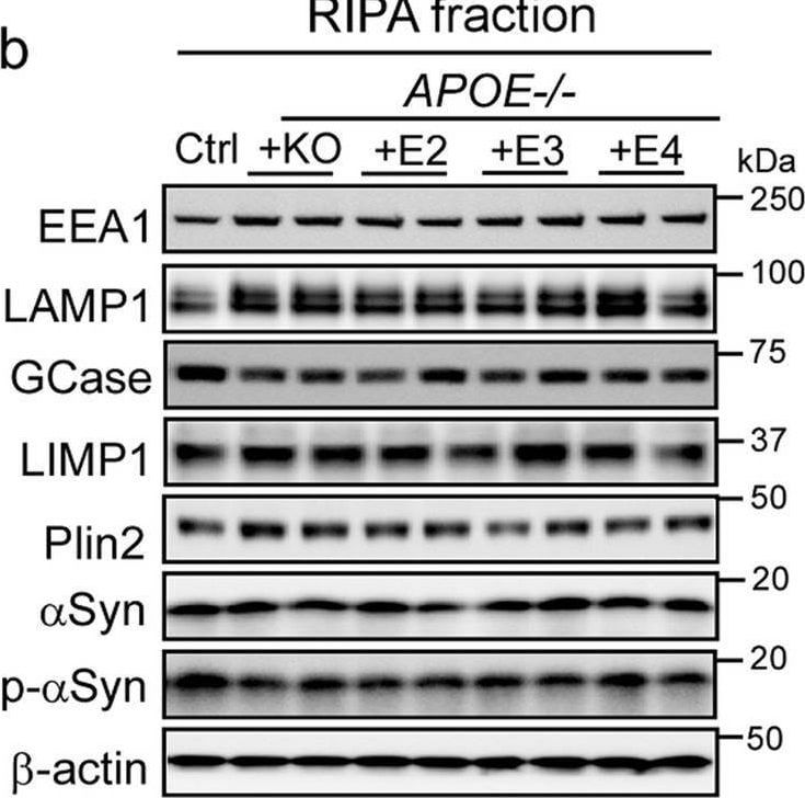 Detection of Perilipin-2 by Western Blot