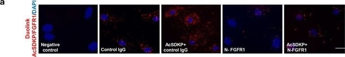 Detection of Human FGFR1 by Immunocytochemistry/Immunofluorescence