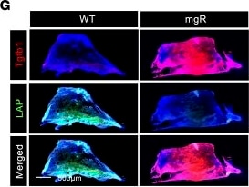 Detection of LAP (TGF-beta 1) by Immunocytochemistry/ Immunofluorescence