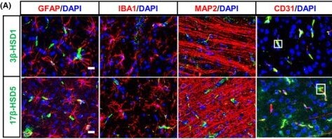 Detection of HDAC2 by Immunohistochemistry