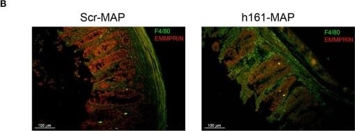 Detection of bntw9ok6eutxni21387t.jpg by Immunohistochemistry