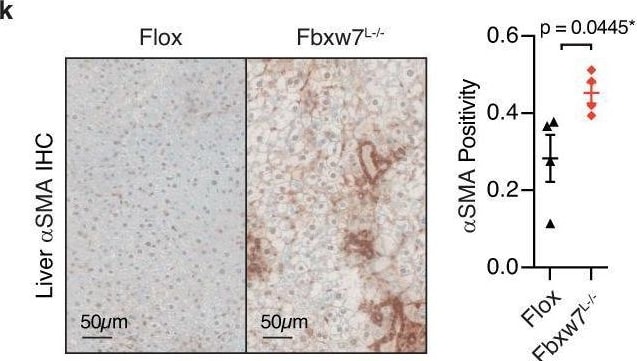 Detection of brqg9ujed6vbcpgfvygo.jpg by Immunohistochemistry