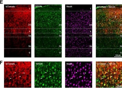 Detection of Neurogranin by Immunohistochemistry