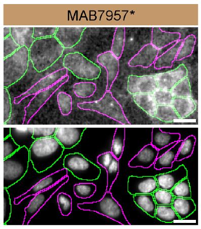 Casein Kinase 2 alpha Specificity is Shown by Immunocytochemistry in Knockout Cell Line.