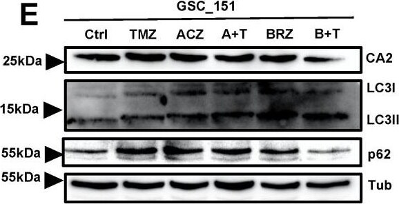 Detection of Human p62/SQSTM1 by Western Blot