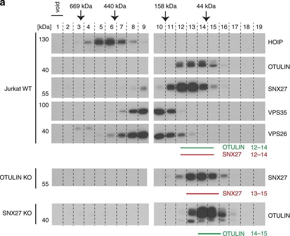 Detection of HOIP/RNF31 by Western Blot