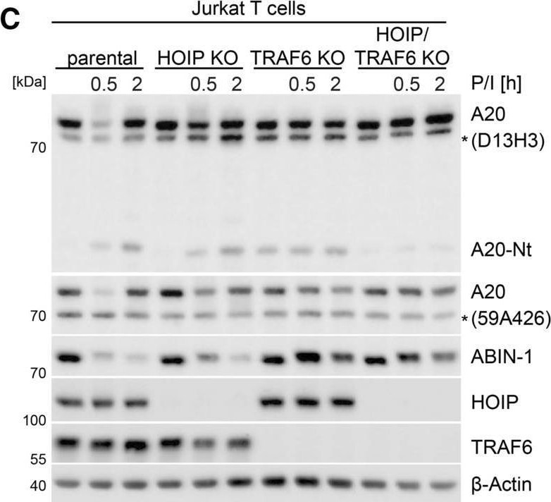 Detection of Human HOIP/RNF31 by Western Blot