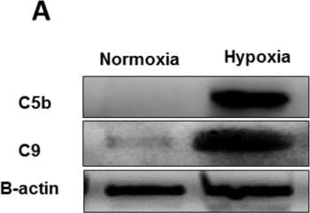 Detection of jw6qbcnnnxxxzw7bdjde.jpg by Western Blot