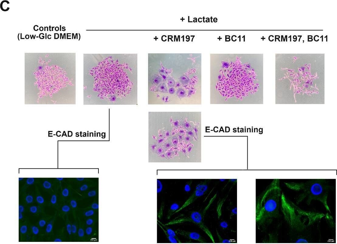 Detection of HCN4 by Immunocytochemistry/ Immunofluorescence