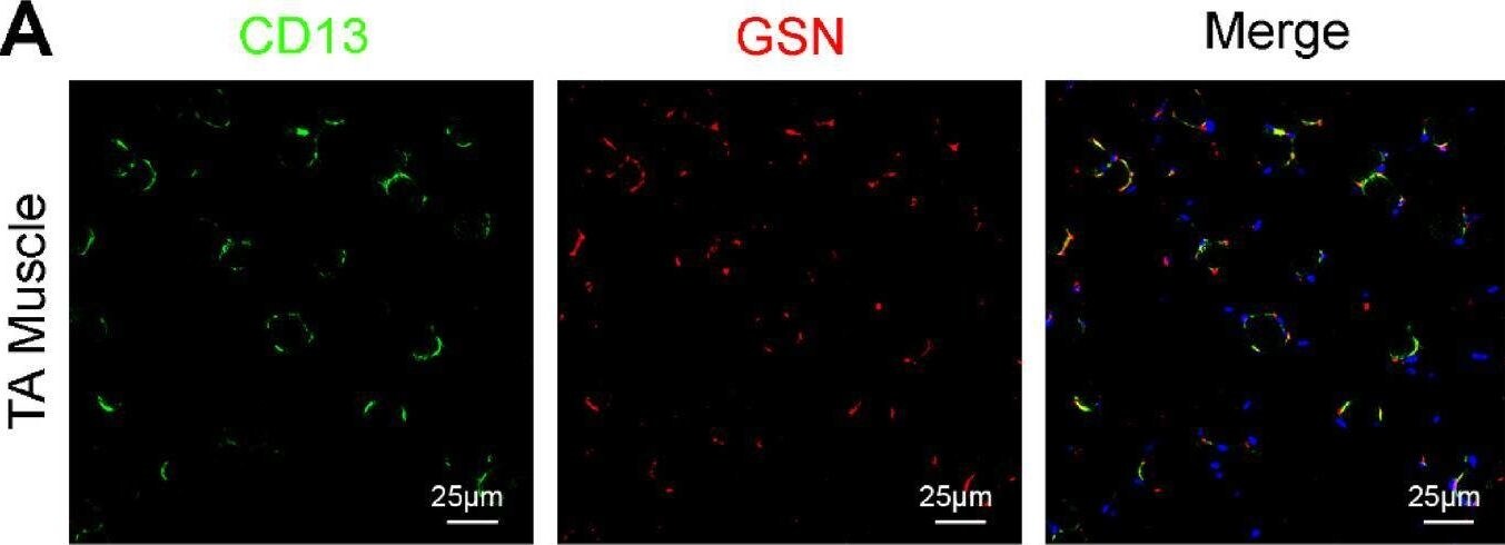 Detection of hbahwou3etm9tvbh4pxm.jpg by Immunohistochemistry