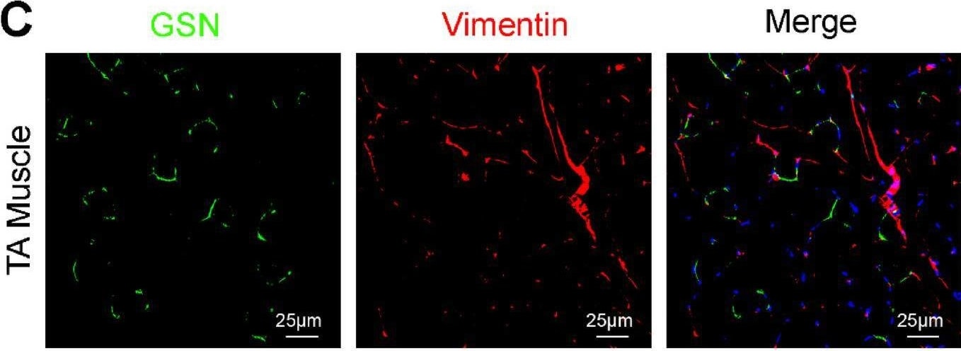 Detection of Gelsolin/GSN by Immunohistochemistry